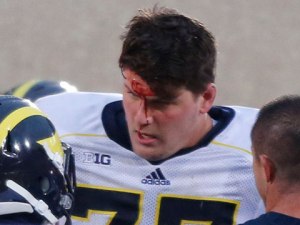 There is something on your forehead